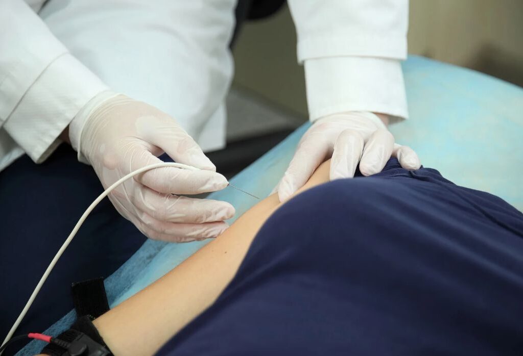 ELETRONEUROMIOGRAFIA NA SONOLAYER