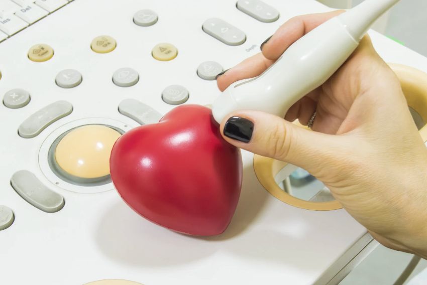 Ecocardiograma
