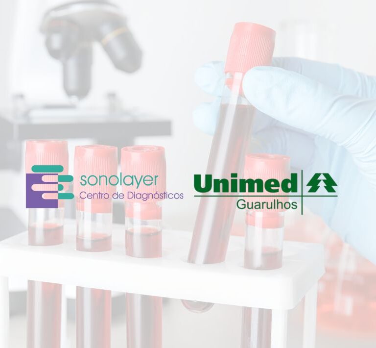 Unimed Guarulhos - exame de sangue