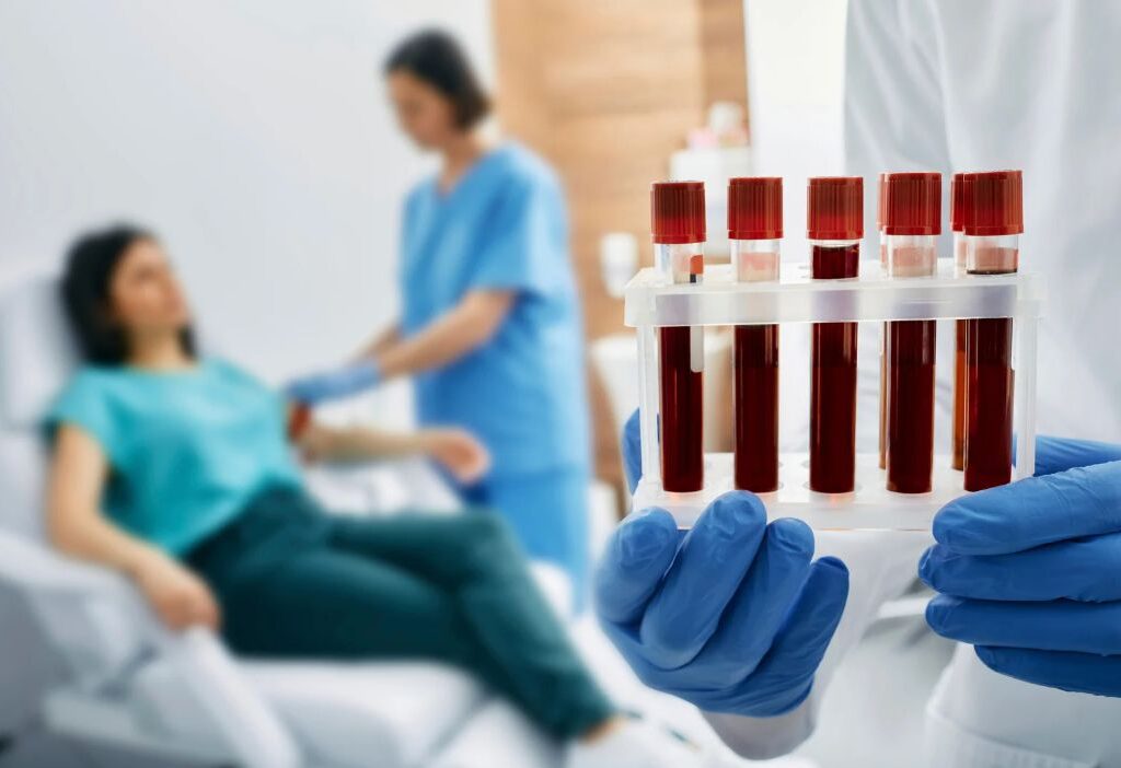 Atendimento Exame de Sangue Unimed Guarulhos